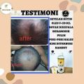SR12 VCO Virgin Coconut Oil 100% Minyak Kelapa Murni Mengatasi Rambut Rontok dan Ketombe. 
