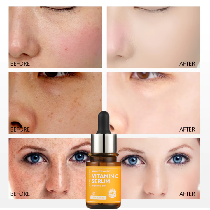 Vitamin A For Skin Tone Evening Reference: Vibrant Glamour Natural Vitamin C Facial Serum 30Ml Whitening