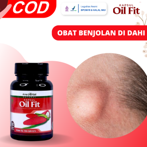 Obat Benjolan Di Dahi Obat Benjolan Di Jidat Obat Benjolan Di Atas Dahi Obat Benjolan Di Atas Alis Obat Benjolan Di Dahi Kiri / Kanan Obat Benjolan Di Kepala Obat Daging Jadi Di Dahi Benjolan keras Dengan Oil Fit