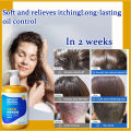 Anti dandruff shampoo，anti-itch shampoo，oil control shampoo 300ml Makes hair fresh, smooth, clean, sterilizes, and deeply cleans the scalp. It can be used by men, women, the elderly, and children.. 