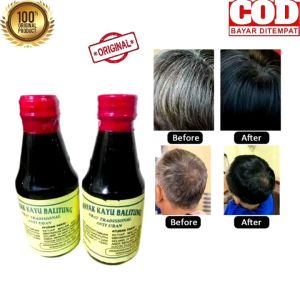 Minyak Kayu Balitung Anti Uban Atasi Kebotakan Perawatan Rambut Uban Perawatan Rambut Rontok