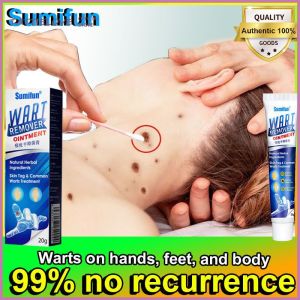 MAFFICK- 20g salap penghilang ketuat terbukti berkesan dalam mengeluarkan tag kulit penghilang penghilang milia skinteg remover (penghilang ketuat krim asli kulit tags remover krim)