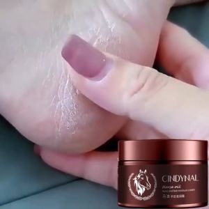 【Set of 3】CINDYNAL Horse Oil Foot Cream 50g – Cracked Heel Repair & Callus Remover – Moisturizing for Dry Rough Feet – Anti Chapping