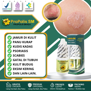 Propolis SM Asli 100% Original Obat Jamur Kulit Panu Kurap Kudis Dan Kadas Psoriasis Scabies Kulit Kering Gatal Di Tubuh Kulit Budug Eksim Kering Dan Basah Ekstrak Propolis Brazil 6 ml