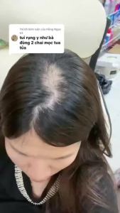 Chai Xịt Kích Thích Mọc Tóc GENIVE Hair Tonic 120ml Thái Lan Ngừa Hói Đầu Giảm Rụng Tóc - Hinohouse