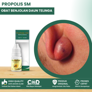 Obat Benjolan Di Belakang Telinga Obat Benjolan Daun Telinga Benjolan Di Telinga Obat Benjolan Di Telinga Kanan Dan Kiri Obat Daging Tumbuh Di Telinga Obat Penghilang Keloid Bekas Luka Tindik Obat Telinga Bengkak Dengan Propolis SM