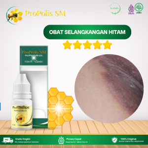 Obat Selangkangan Hitam Obat Selangkangan Gatal Dan Hitam Obat Infeksi Jamur Selangkangan Obat Selangkangan Gatal Obat Selangkangan Lecet Obat Selangkangan Gatal Dengan Propolis SM
