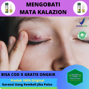 Obat Oles Mata Kalazion Herbal Pembengkakan Di Mata Bagian Atas Kalazion Di Kelopka Mata Mengobati Penyakit Benjolan Kalazion Menahun Sakit Mata Bintitan Bintit Di Mata Bengkak Bisul Cenang Di Mata Cocok Untuk Anak Dan Dewasa - Propolis Sm Brazil