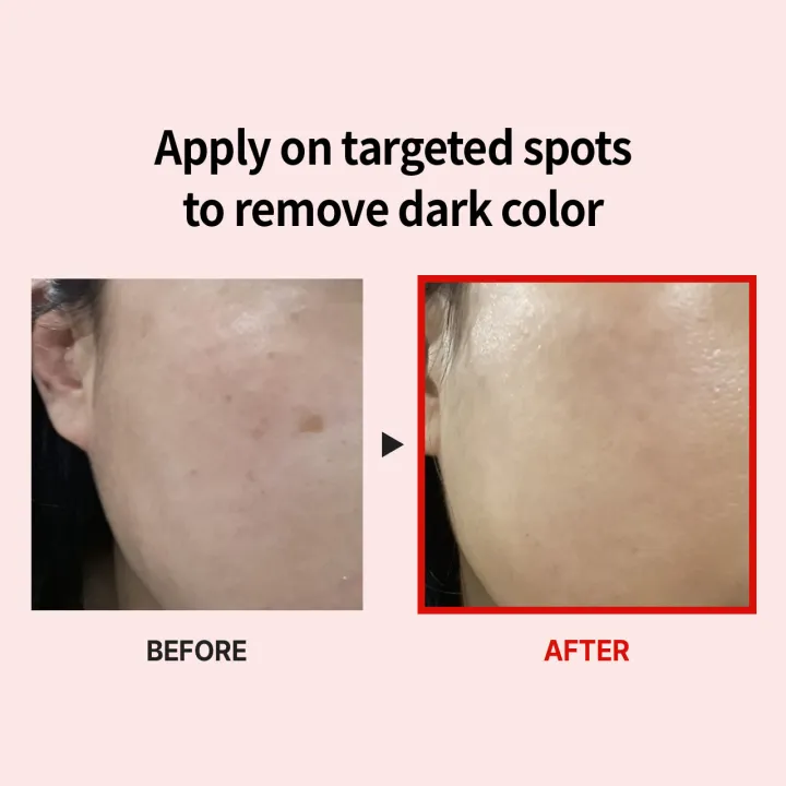 @springbootapplication 之 @springbootconfiguration -... MEDIPEEL MELANON X CREAM 30ml (whitening, brigtening, pigmentation ...