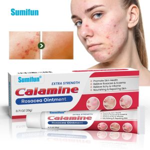 20G Sumifun Rosacea Thuốc Mỡ Điều Trị Mụn Mũi Đỏ Mụn phục hồi vết sẹo Kem kiểm soát dầu Dưỡng Ẩm Vẻ Đẹp Sức Khỏe chăm sóc da mặt