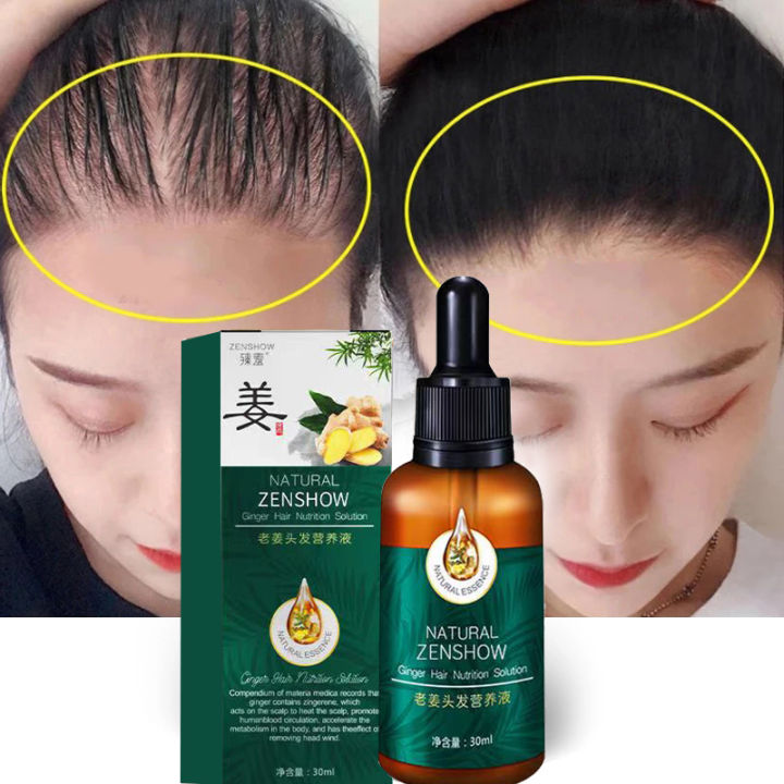 Hair Growth And Anti Loss Hair Care Serum Ginger Hair Care Oil Hair Loss