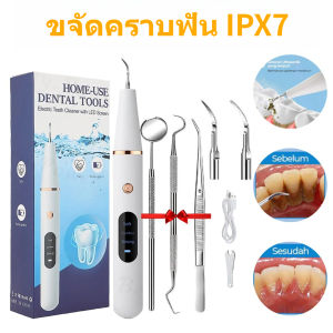 เครื่องขูดหินปูนไฟฟ้าระบบอัลตราโซนิก ควบคุม 3 ระดับความเร็ว ใช้งานปลอดภัย ลดคราบหินปูนได้ดี