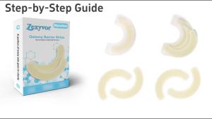 20 ชิ้น แถบกั้นทางการแพทย์ เกรดไฮโดรคอลลอยด์ เทปกั้นผิวสำหรับโคลอสโตมี อิเลออสโตมี ถุงยูโรสโตมี แหวนยืดหยุ่นสำหรับทางการแพทย์ อุปกรณ์เสริมสำหรับสโตมา