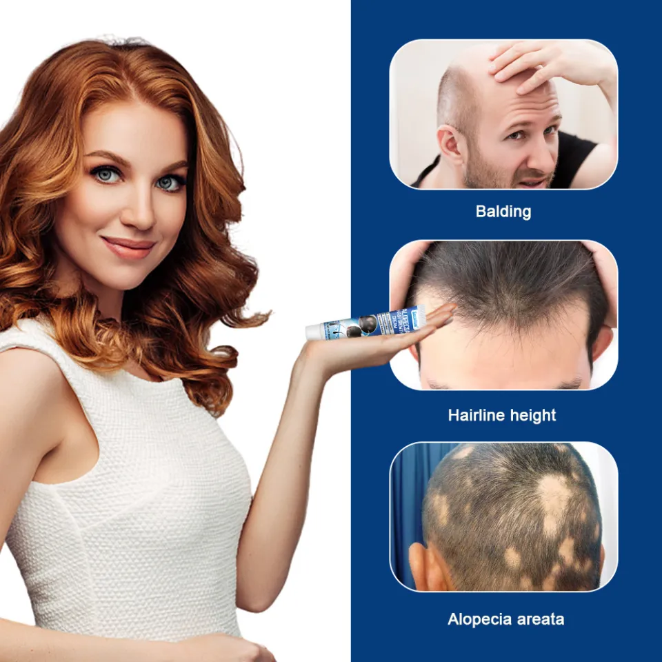 Alopecia Hair Growth Cream, Herbal Scalp Care for Solid Hair Roots