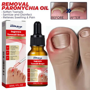 Serum Nấm Móng Phục Hồi Móng Thối Móng Hư Nấm Móng Giúp Đẹp Móng Từ Thảo Dược