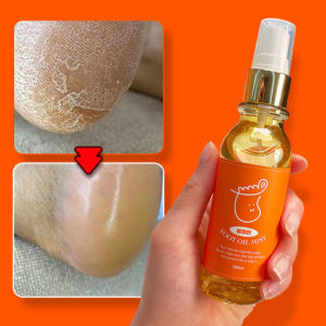 Refreshing Foot Oil Mist Soles Heels Cracked Feet Spray Callus Remover 100ml