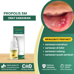Obat Sariawan Obat Sariawan Akut Sariawan Menahun Obat Sariawan Di Bibir Sariawan Radang Sariawan Berdarah Sariawan Susah Sembuh Sariawan Herbal - Propolis SM
