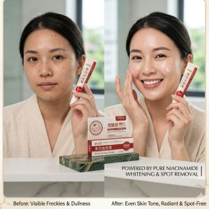 [Yi Si Tang] 30g Whitening & Spot Removal Cream | Pure Niacinamide Vitamin B3 | Brightening Anti-Freckle Hydrating Non-Greasy Moisturizer | Local Seller Authentic