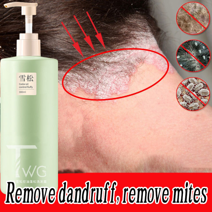 Sea Salt Shampoo AntiDandruff Shampoo Deep Cleansing Shampoo 380ml