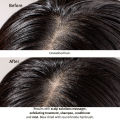 [Scalp Care] AVEDA Scalp Solutions Exfoliating Scalp Treatment 150ML. 