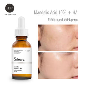 Free Shipping The Ordinary Mandelic Acid 10% + HA Peeling Lotion For Face Exfoliating Whitening Blackhead Remover Exfoliator For Face Pimple Marks Acne Scars Remover For Face Skin Care Fast delivery & Ready Stock