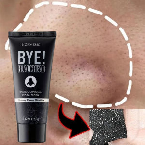 Kem lột Mụn Than Tre Hút sạch mụn cám mụn đầu đen. Thải độc chì- Sáng da