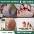 Obat Jamur Kaki, Infeksi Jamur pada Kulit Kaki, Tinea Pedis, Kuku Berjamur dan Rusak, Jempol Kaki Cantengan, Obat Telapak Kaki Bolong Bolong, Kaki Rayapan, Pitted Keratolysis, Kaki Pecah Pecah, Mengelupas Dioles Dengan Propolis SM. 