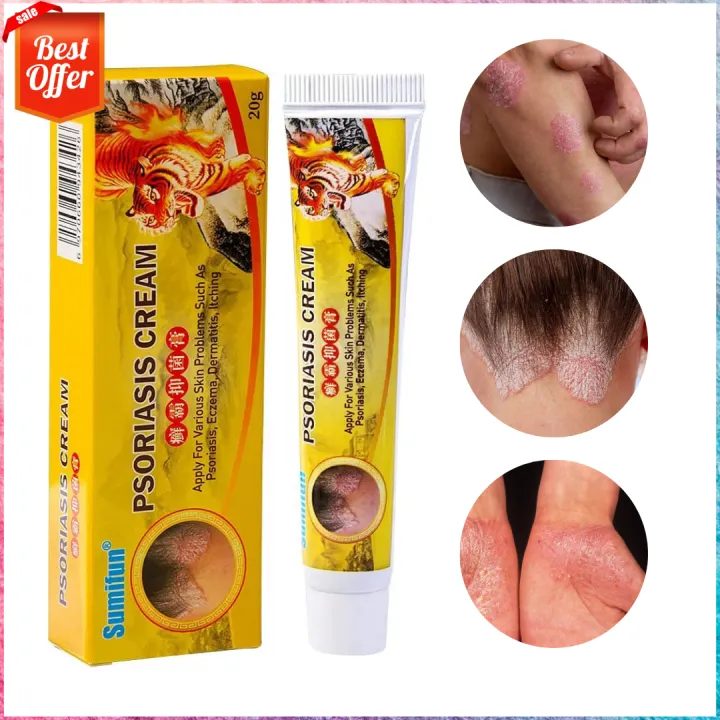 Sumifun Psoriasis Cream, Eczema Cream for Dermatitis, Psoriasis ...