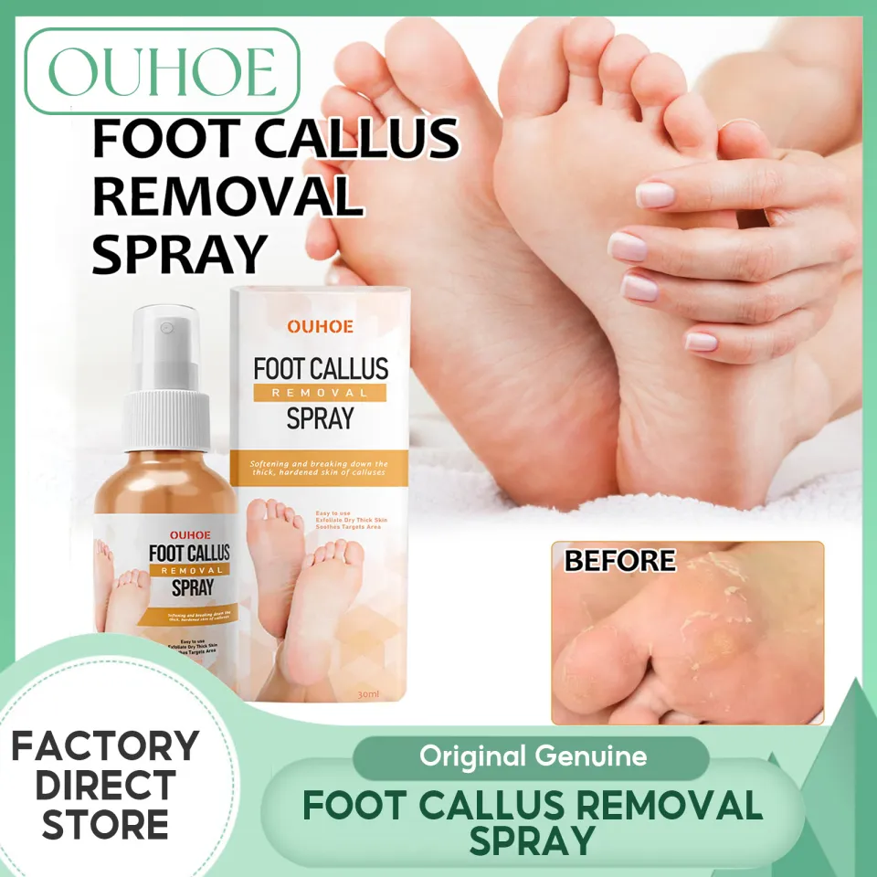 Ouhoe Foot Callus Removal Spray Foot Peeling Removal Dead Skin