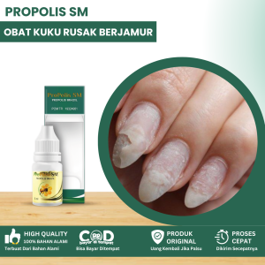 Obat Kuku Rusak Berjamur Jamur Kuku Obat Kuku Berjamur Kuku Kering Kuku Hitam Obat Kuku Kuning Obat Kuku Bau Busuk Kuku Rapuh Obat Kuku Rusak Parah Dengan Propolis SM