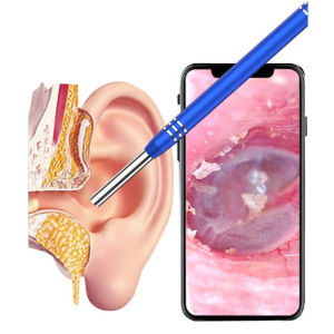 หู กล้องเอนโดสโคป 3in1 เครื่องมือทำความสะอาดหู เลือกหูภาพ HD ที่อุดหูมัลติฟังก์ชั่น พีซี Android กล้องจิ๋ว 5.5 มม หู Otoscope