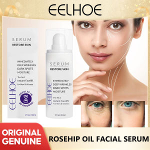 Eelhoe Anti Aging Serum Remove Wrinkle Forehead Line Fade Pigmentation Melanin Removal Whitening Brighten Melasma Anti Dark Spot Serum Oil Whitening Freckle Moisturizing Lightening Fine Lines Brightening Anti Wrinkle Repairing Essence