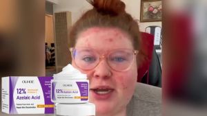 🔥 Hot!OUHOE Azelaic Acid Acne Care Cream Gentle Moisturizing Cream for Improving Facial Acne and Brightening Hydrating Face Cream