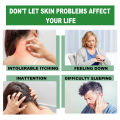 gamot sa kati kati sa balat skin fighter atoderma cream original ointments and creams eczema treatment dermacare cream for psoriasis skin deases antibacterial cream. 