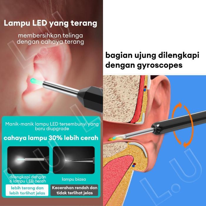 %E3%80%90IN%20STOCK%E3%80%91ALAT%20PEMBERSIH%20TELINGA%20LED%20EAR%20SPOON%20TERHUBUNG%20DENGAN%20EAR%20SPOON%20CERDAS%20UNTUK%20MEMBERSIHKAN%20SALURAN%20TELINGA%20ANAK-ANAK,%20DEWASA,%20DAN%20LANSIA%20SECARA%20NIRKABEL%20DENGAN%20WIFI%20TAHAN%20AIR.%20NON-MEDIS%20BLACK%20-%20Image%204
