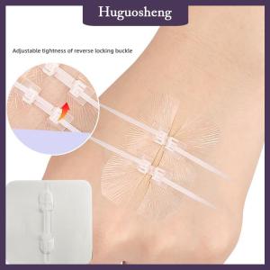 [huguosheng] Zipper Band-aid Painless Wound Closure Device Suture-free Wound Dressing Patches Zip Suture Reducer Band Aid