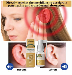 Ear Care Spray Relieves Ear Discomfort Propolis Care Spray Inner Ear Blockage Tinnitus Spray