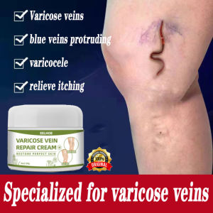 【Local delivery】 Topical Varicose Vein Remedy Ointment Blood Vessels Soreveins Swelling Spider Veins stood out raised  Pain Relief Effective Keeps Legs Moisturized Natural Ingredients for man and women