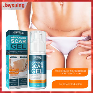 Jaysuing Advanced Scar Gel New Style Acne Scar Removal Cream Remove Acne Smoothing Whitening Body Skin Care Pimples Stretch (50ml）