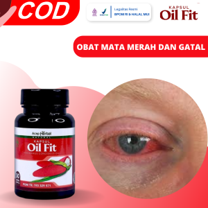 Obat Mata Merah Dan Gatal Obat Mata Gatal Obat Mata Merah Obat Alergi Mata Obat Penyakit Konjungtivitis Obat Mata Merah Dan Kering Obat Iritasi Mata Alergi Okular Obat Sakit Mata Dengan OilFit
