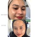 DAVIENA SKINCARE PAKET HEMAT GLOWING | skincare wajah glowing bpom skincare 1 paket original. 