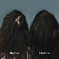 [เซตแชมพู+เซรั่ม] L'Oreal Professionnel SERIOXYL ADVANCED SHAMPOO 300ML & DENSIFYING SERUM 90ML (แชมพูแก้ผมร่วง,ผมร่วง,L'Oreal Pro,L'Oreal Professional,LOreal Pro,LOreal Professional). 
