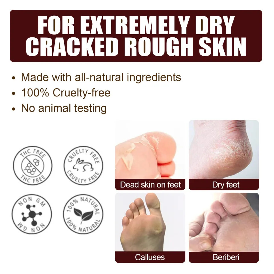 Hot Sale】EELHOE Anti-Drying Crack Foot Cream Heel Cracked Repair