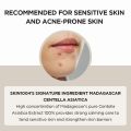 SKIN1004 Madagascar Centella Ampoule 100ml Repair skin acne marks and strengthen skin barrier. 