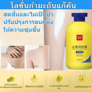 บรรเทาอาการคัน โลชั่นเพิ่มความชุ่มชื้น โลชั่นบํารุงผิว ฟื้นฟูผิว ให้ความชุ่มชื้น ปรับปรุงความแห้งกร้าน เรียบ/โลชั่นเด็ก ให้ความชุ่มชื้นและบรรเทาอาการคัน