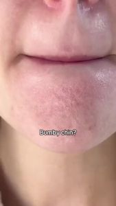 Hot New Item SKIN1004 Poremizing Quick Clay Stick  Face  Skincare For Pore Minimizing Facial Clay  With Cenla Pore Minimizer For Sebum Control Pink Mud  Kor