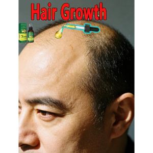 The dormant hair follicles awaken and the head becomes more luxuriant