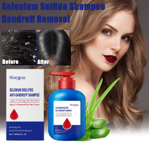new Selenium Sulfide Hair Shampoo Deep Cleansing Scalp Remove Dandruff Refreshing Strengthen Hair Roots Smoothing Soften Shiny Hair hot