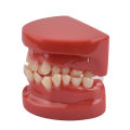 3D Resin Dental Model Teeth Malocclusion Model For Demostration Teaching Dental Students Study Oral Dentistry Products. 