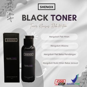 Black Toner Shenox Toner Khusus Flek Hitam Obat Penghilang Noda Hitam Bekas Jerawat Black Toner Shenox 100 ml BPOM Toner Khusus Flek Hitam Toner Wajah Penghilang Flek Hitam Membandel Toner Pemutih Toner Pencerah Toner Glowing Di Muka